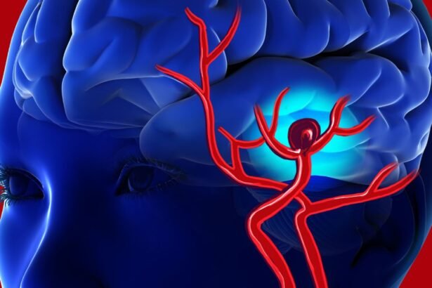 Revolutionizing Brain Aneurysm Management with Next-Generation AI – Healthcare AI