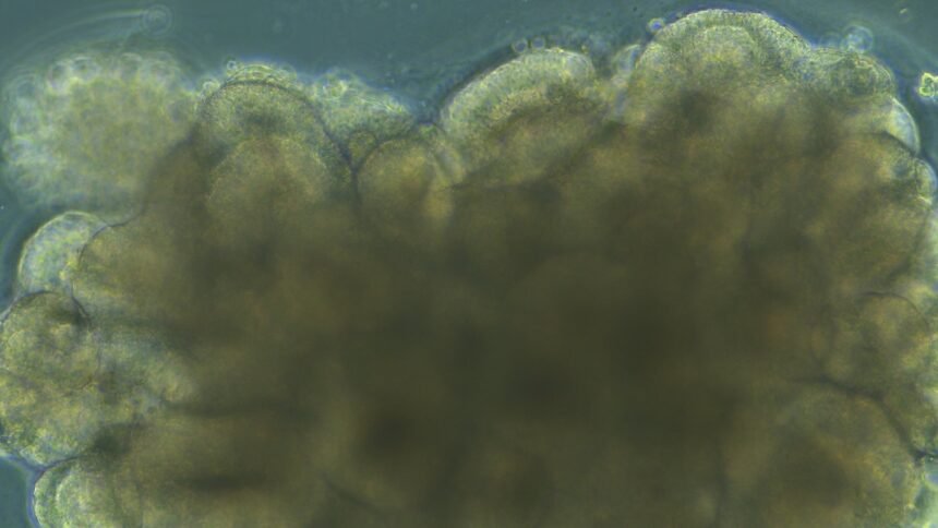 A Ball of Brain Cells on a Chip Can Learn Simple Speech Recognition and Math