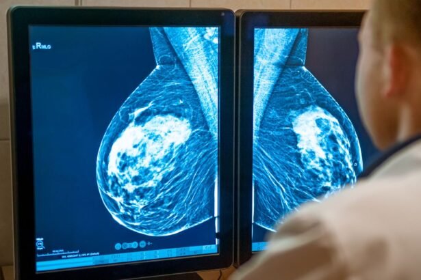 How Digital Breast Tomosynthesis Revolutionizes Mammography – Healthcare AI