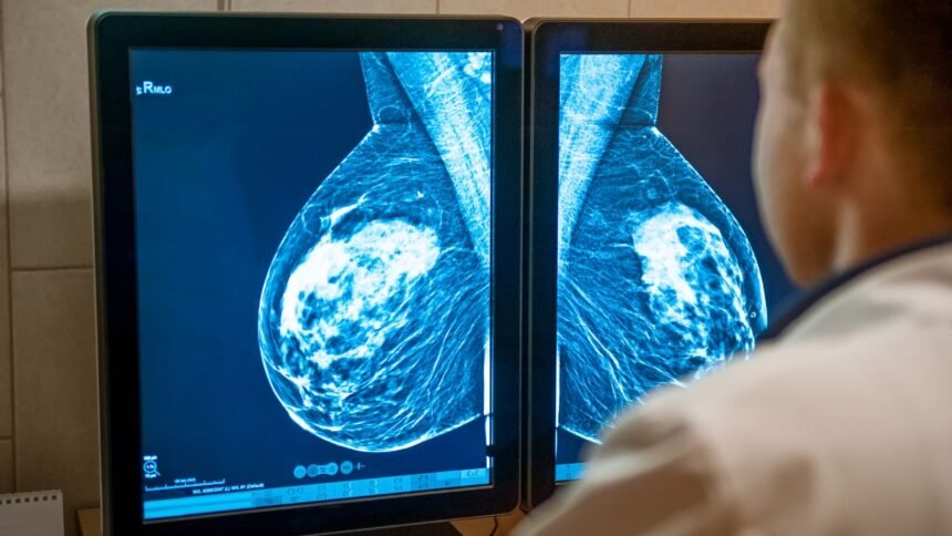 How Digital Breast Tomosynthesis Revolutionizes Mammography – Healthcare AI