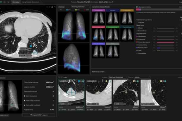 AI’s Role in Medical Imaging for Earlier Anomaly Detection