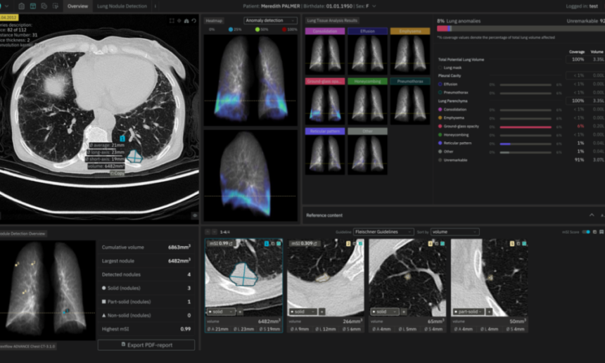 AI’s Role in Medical Imaging for Earlier Anomaly Detection