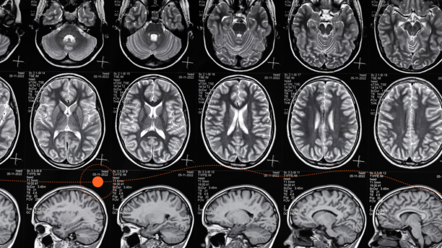 Is Preventive Radiology the Next Specialty? – Healthcare AI