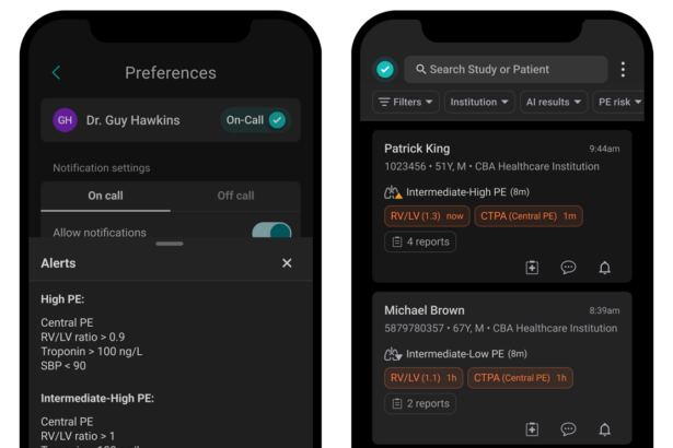How Aidoc’s New Automated Dynamic Risk Stratification Feature Benefits PERTs – Healthcare AI