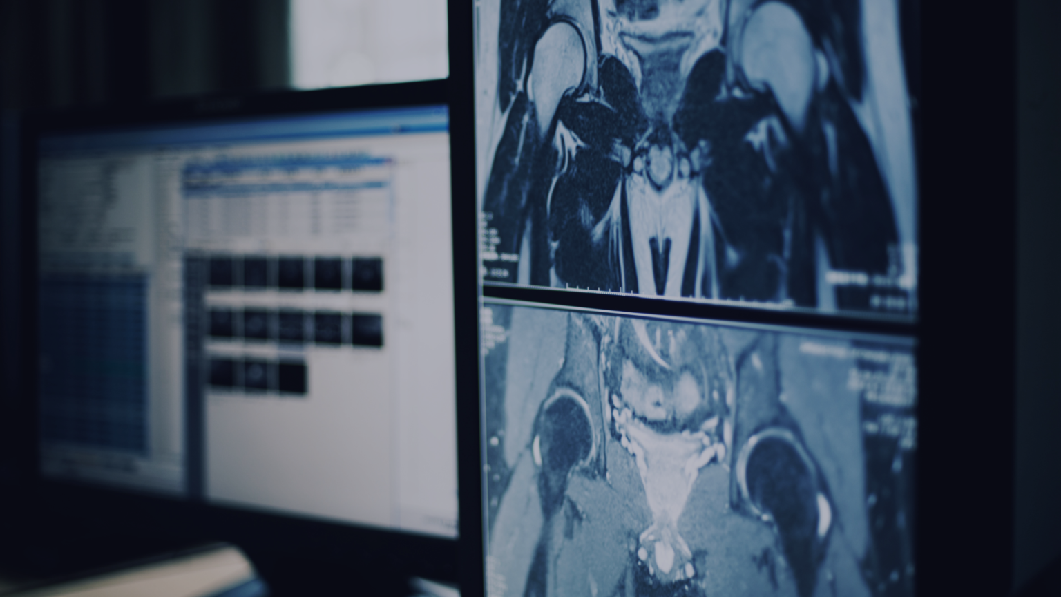 Radiologists + AI: Driving Enhanced Awareness and Elevating the Standard of Care – Healthcare AI