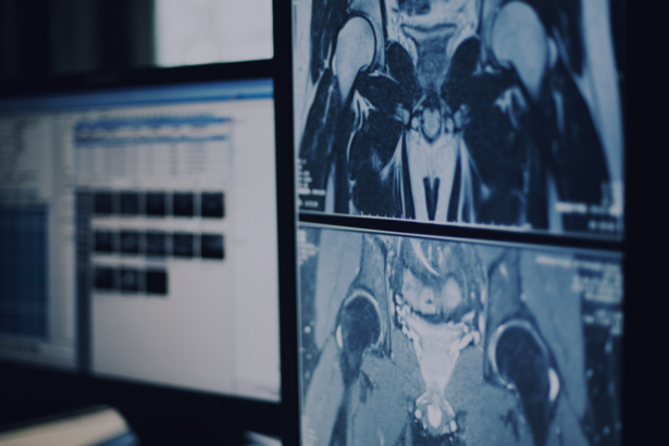 Radiologists + AI: Driving Enhanced Awareness and Elevating the Standard of Care – Healthcare AI